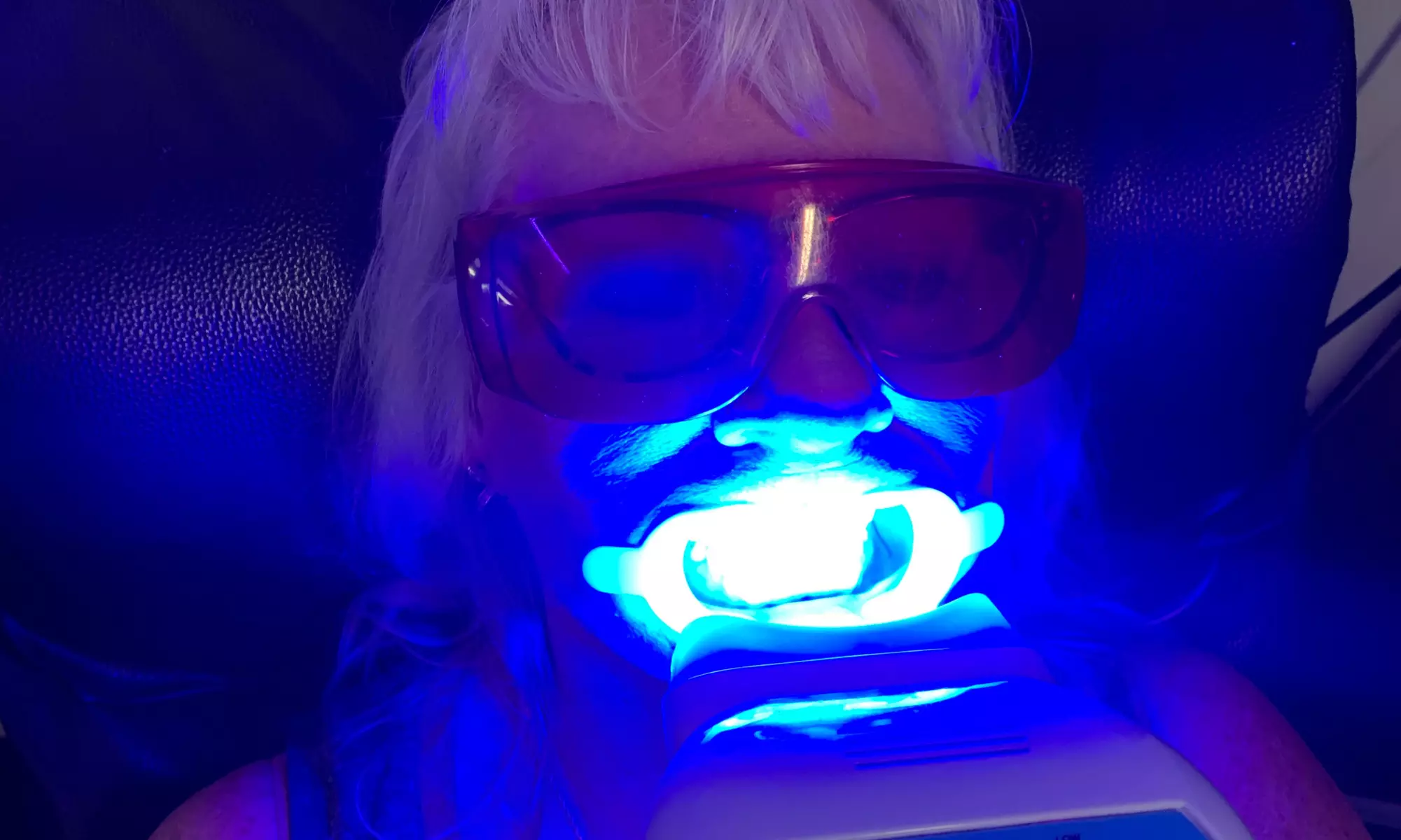 Brighten Your Smile with a 60-Minute In-Office Laser Whitening