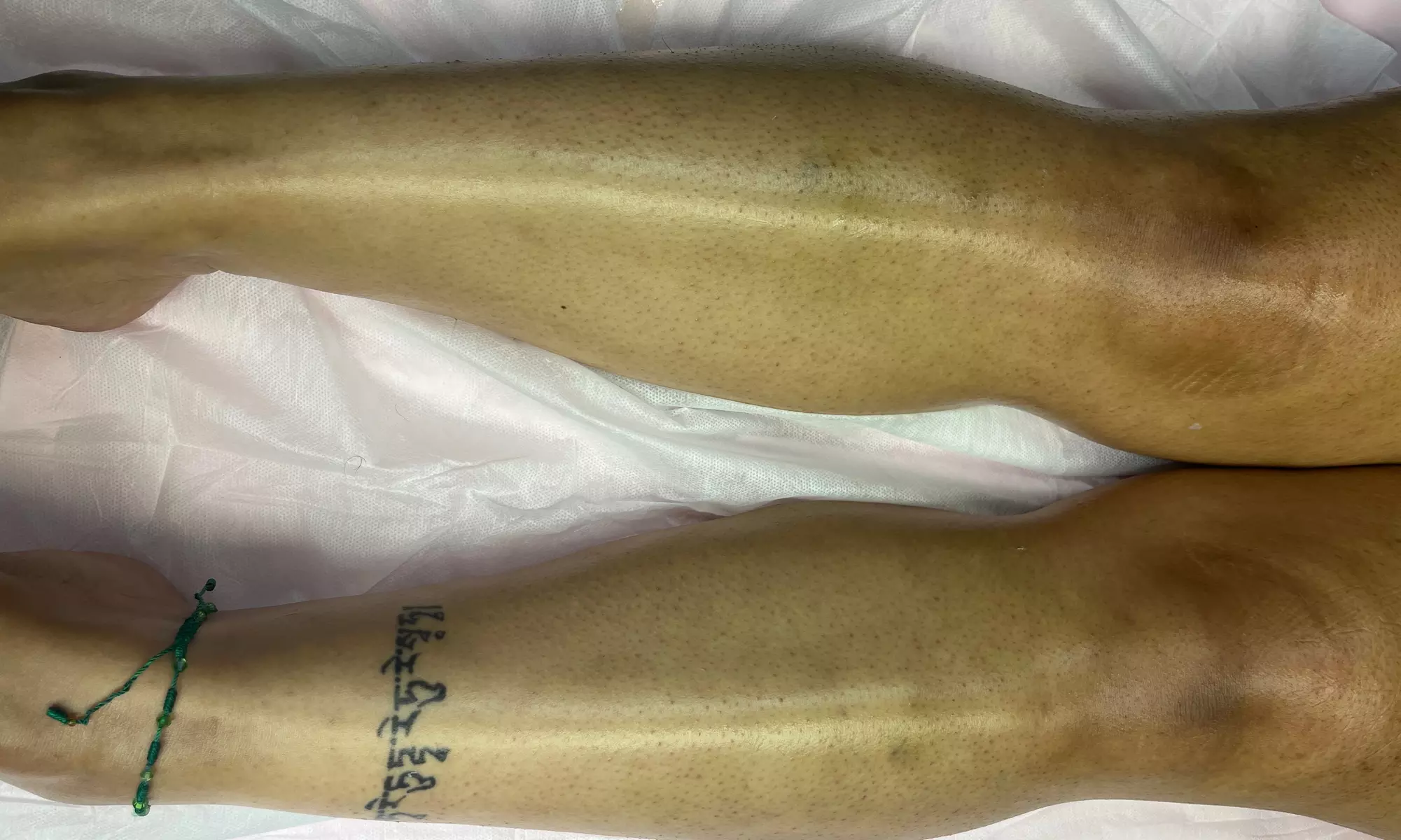 Expert Waxing & Targeted Hair Removal in a Professional Suite