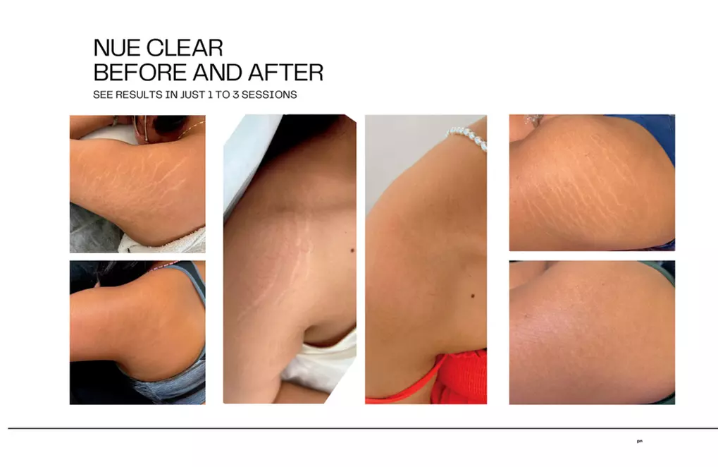 Up to 76% Off on Permanent Makeup at Scarless Artistry - Primary Image