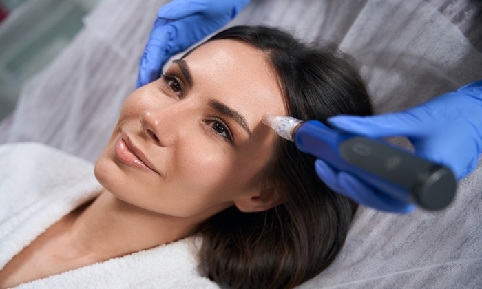 Up to 64% Off on Micro-Needling at Pari’s Medspa