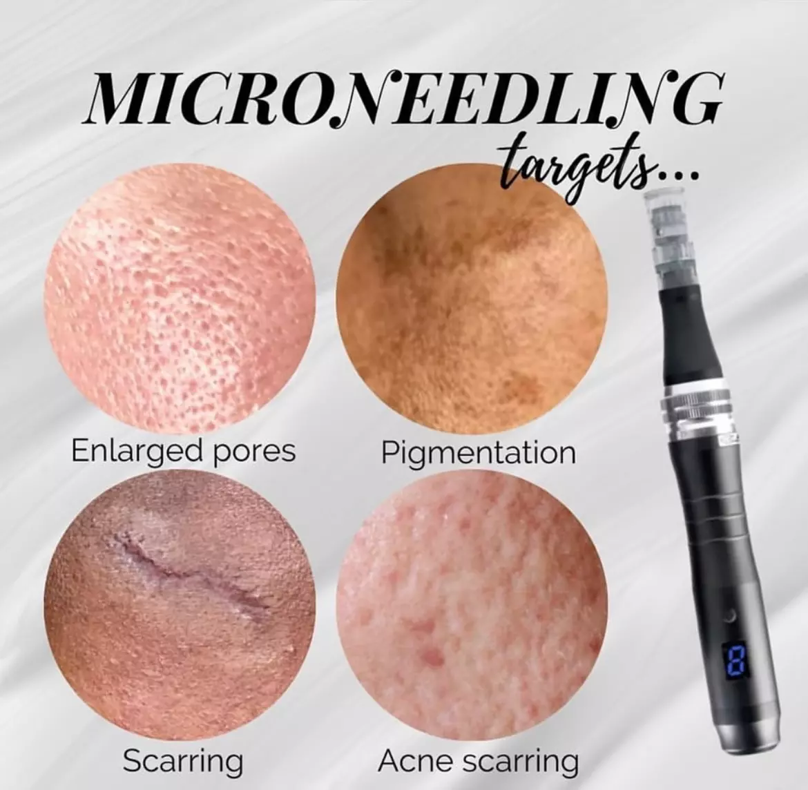 Up to 37% Off on Micro-Needling at Revive Esthetic
