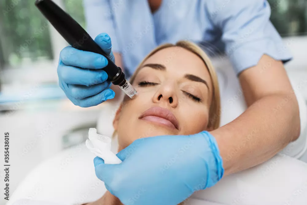 Up to 56% Off on Micro-Needling at Nikandpea - Primary Image