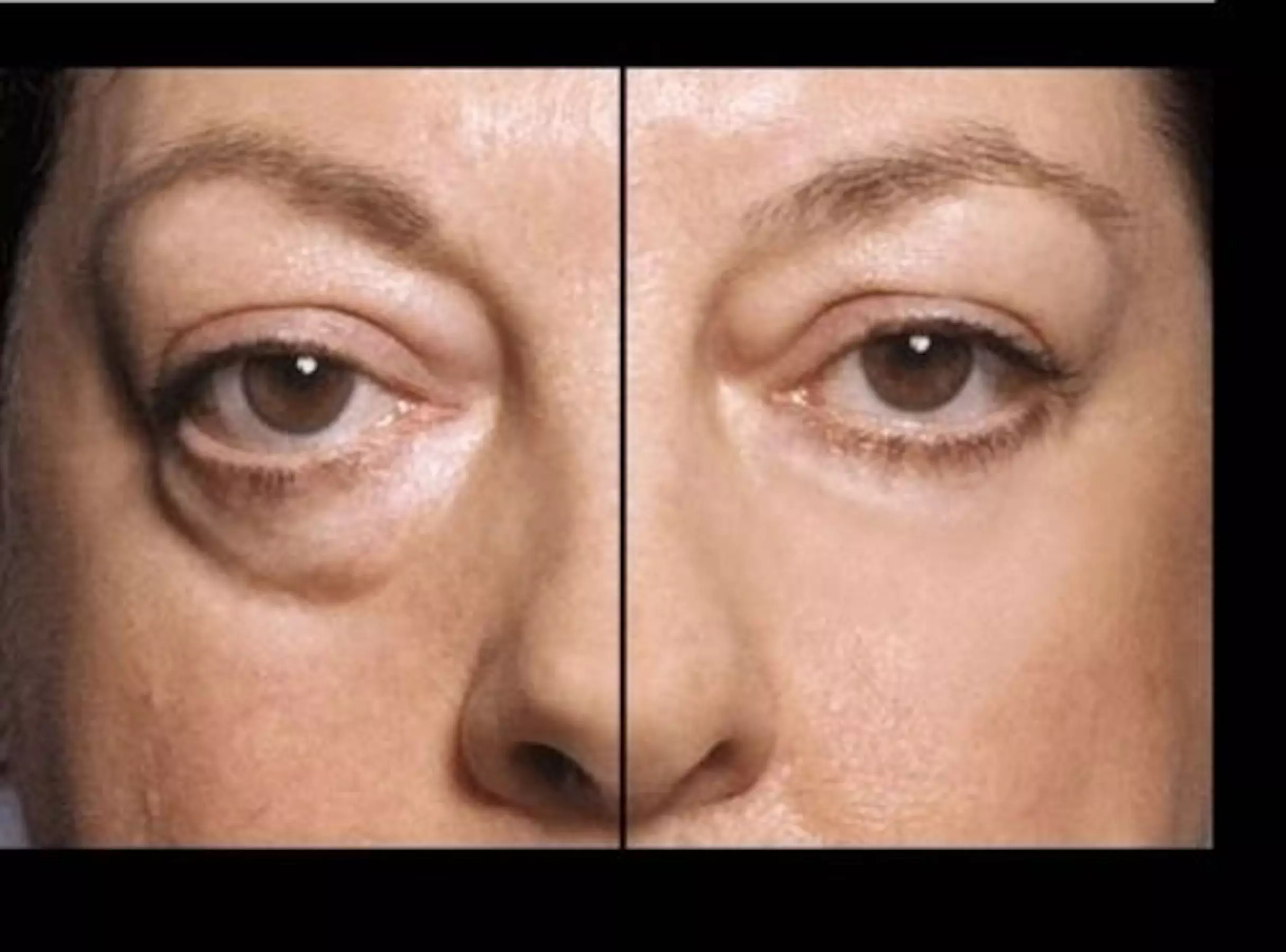 Up to 54% Off on Facial at TRINITYFSA Wellness Beauty Cafe