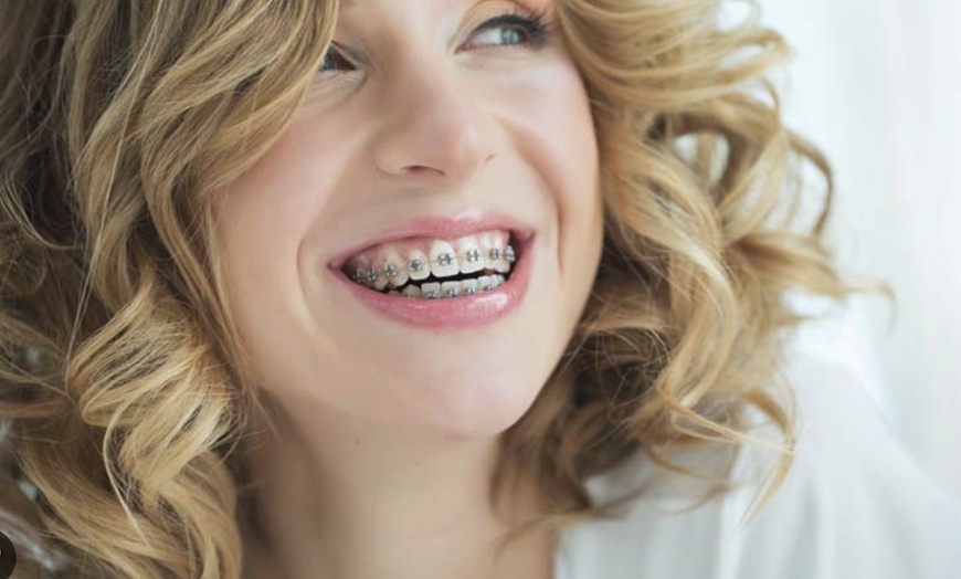 Image 1: Up to 31% Off on Braces at Ortho London Ltd