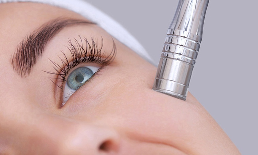 Image 1: Up to 75% Off on Microdermabrasion at Doll Beauty By E.B