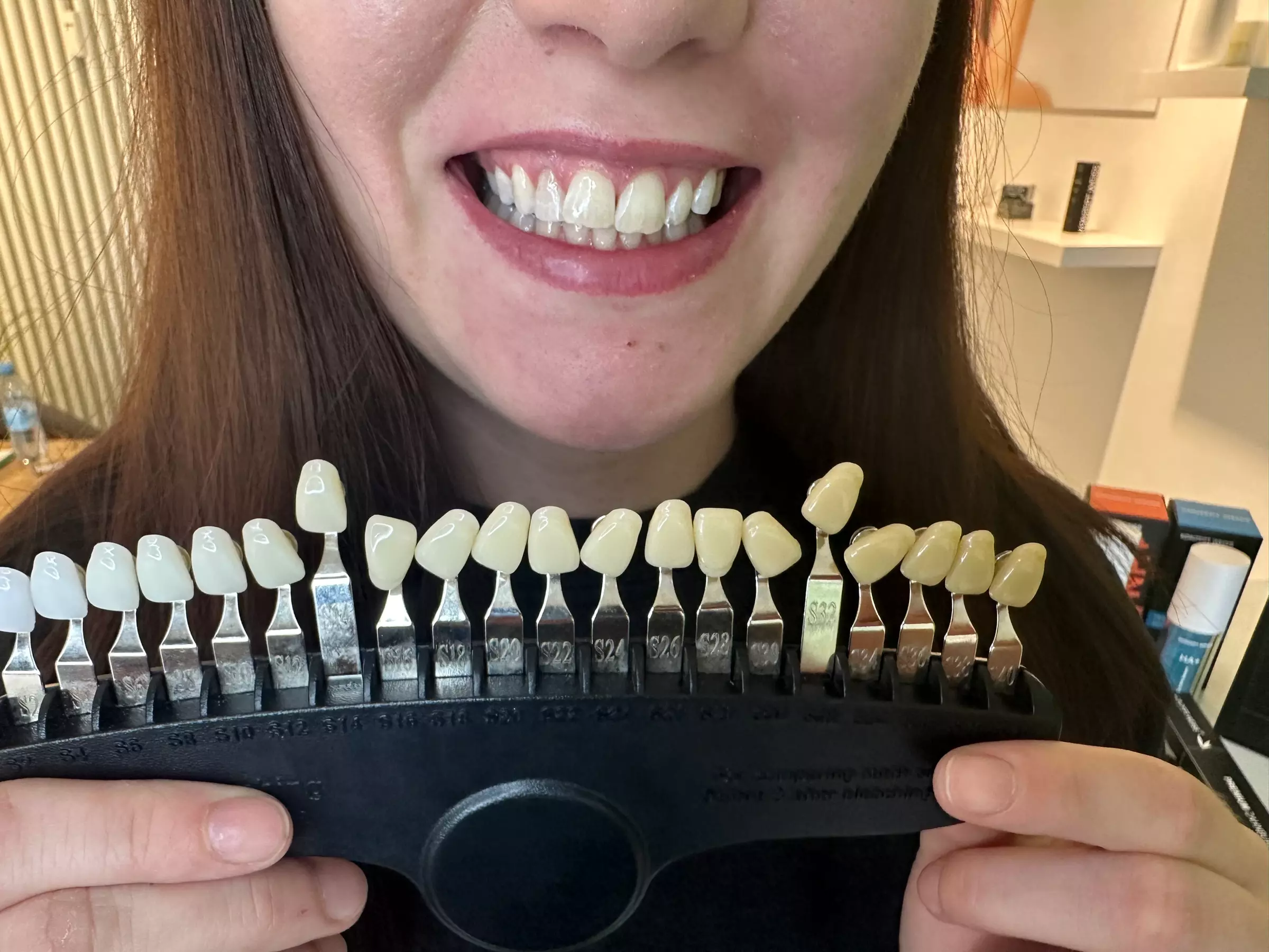 Kosmetisches Zahn-Bleaching