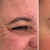 Image 3: 20, 40, or 60 Units of Letybo® Treatments for Smoother Skin