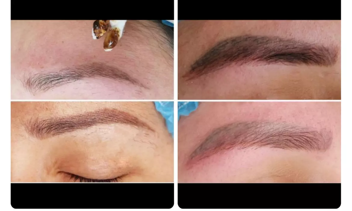 Up to 20% Off on Tattoo Removal at Aesthetic Brows_AM - Second Medium