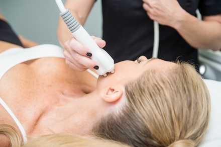 One Radio Frequesncy Skin tightening treatment for Face, Neck or Stomach - 4D Skin Care Clinic