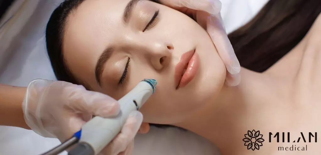 Up to 77% Off on Micro-Needling at Medspa | Milan Medical - Primary Image