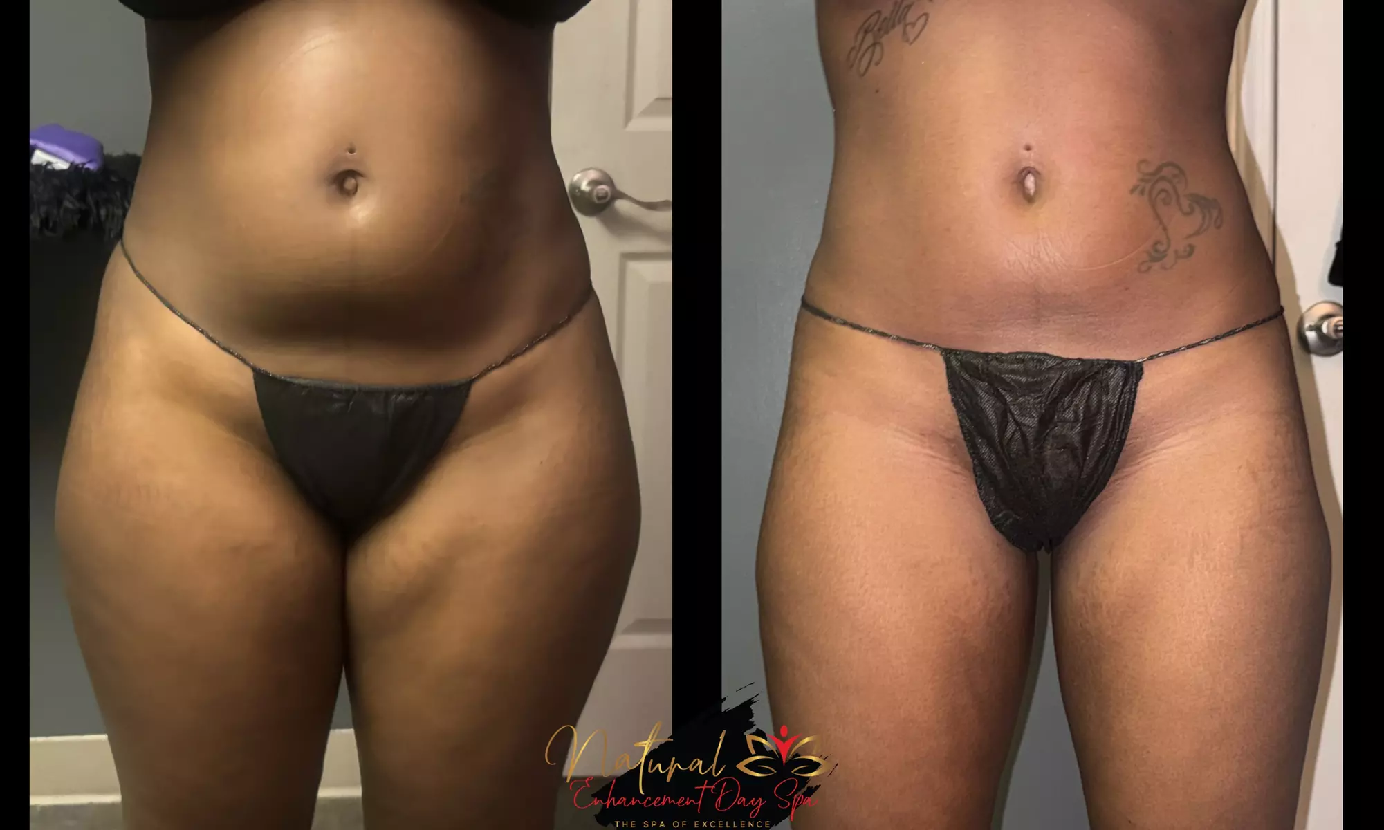 Up to 65% off on Weight Loss Management Services 