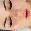 Image 1: Refresh Your Skin with Golden Girl Treatment 55+ or Lymphatic Facial