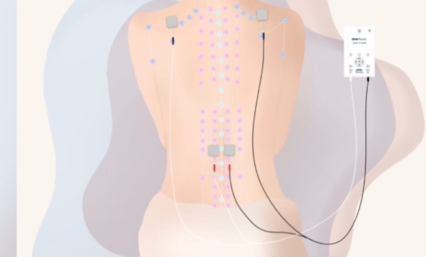 Image 2: Bis zu 70% Rabatt auf Current Puncture (Elektrostimulation)