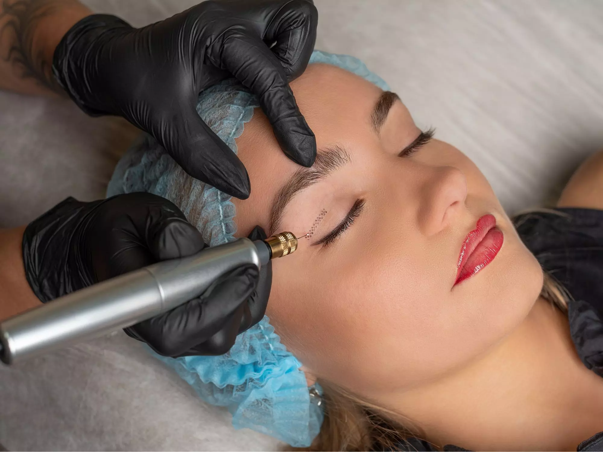 Plasma Fibroblast at London Body Centre