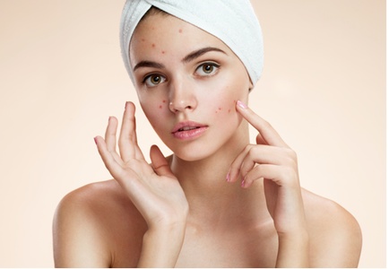 Revolution Acne Facial and Microdermabrasion  - One session - Glow Matrix