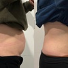 Image 5: Up to 61% Off on Ultrasonic Fat Reduction at ILLUME Skin Spa