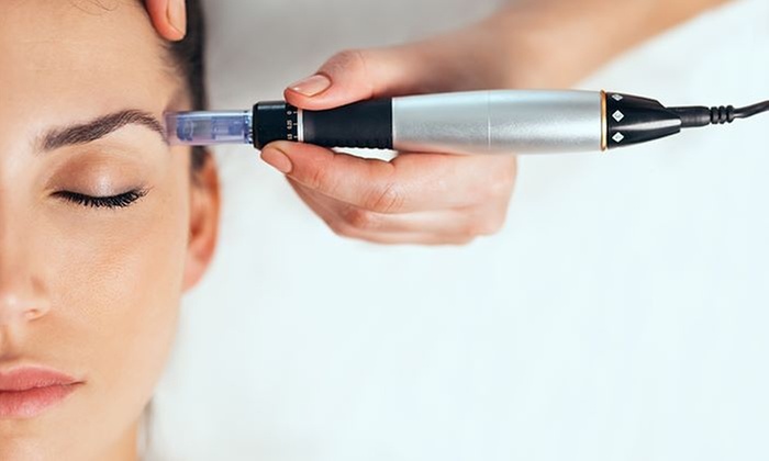 Micro-Needling at Vancouver Fat Loss