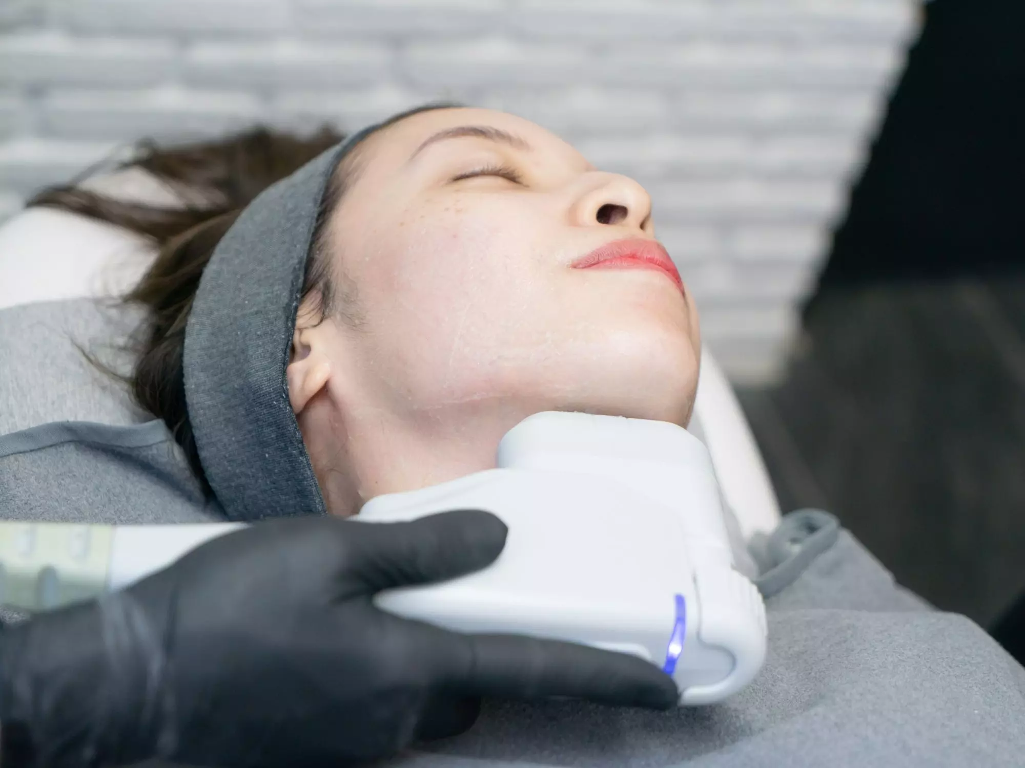 Up to 52% Off on HIFU at London Body Centre