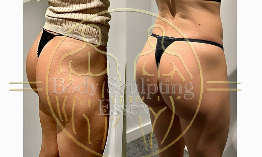 Image 1: Tone and Relax with Electromagnetic Sculpting w/ Private Sauna & More!