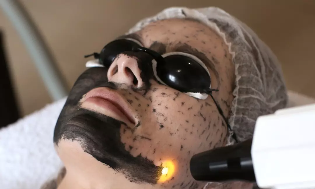 Peeling węglowy Black Doll dla zdrowej i promiennej skóry w Permanent Makeup & Laser Sylwia Kasza (do -45%) - Primary Image