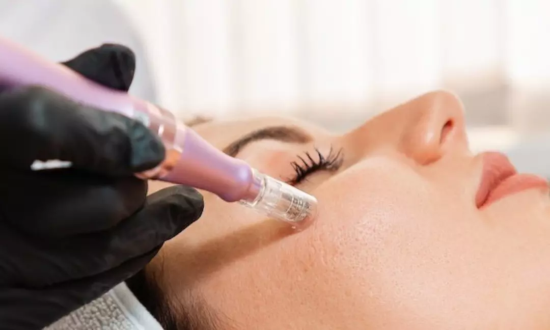 Discover Beauty Factory Boutique Spa's Facial Treatments -- Up to 45% off!