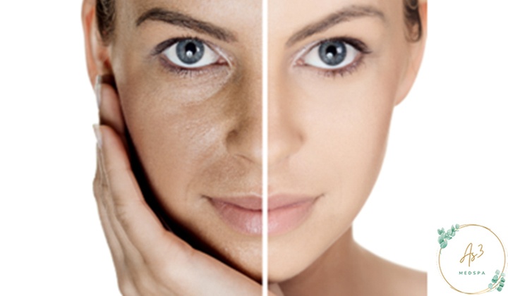 Revitalize Your Skin With a Hollywood Carbon Peel Treatment (Up to 50% Off) - Primary Image