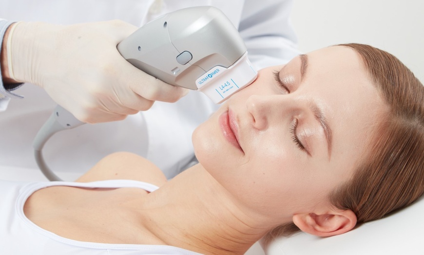 Image 1: Facial - Ultherapy / Ultrasonic at skin & brows clinic