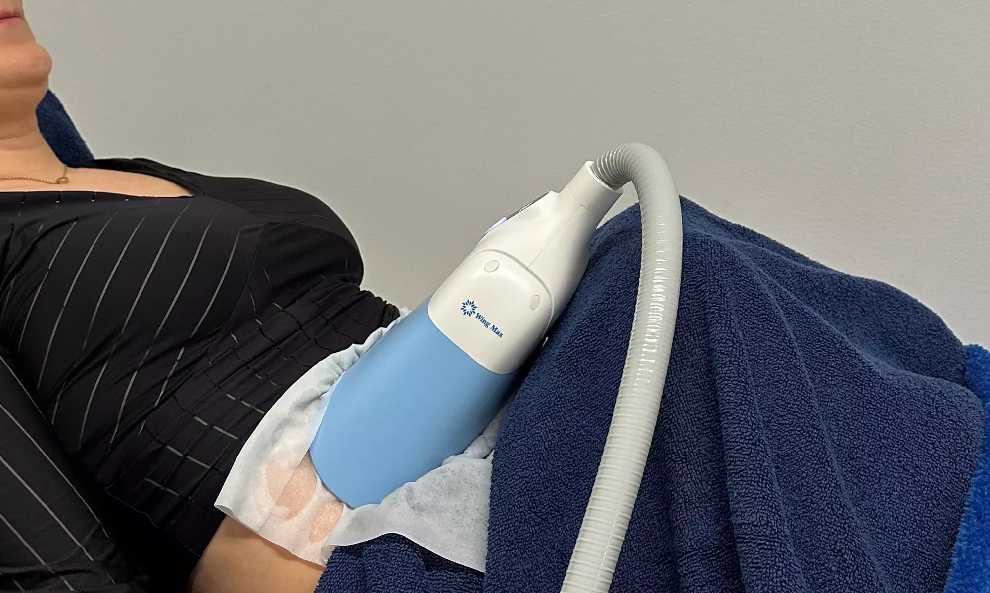 1, 2 oder 3 Kryolipolyse-Behandlungen an einer Zone für 1 Person