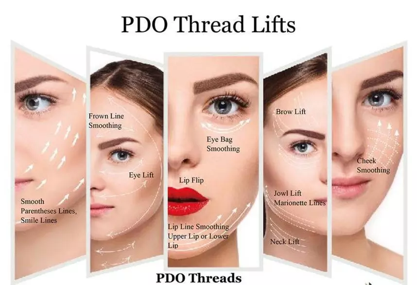 90-Minute PDO Thread Skin-Lifting Session at Forever29 MedSpa - Primary Image
