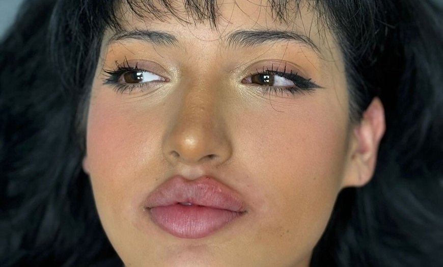 Image 1: Up to 32% Off on Lip Enhancement at Metamorph Med Spa