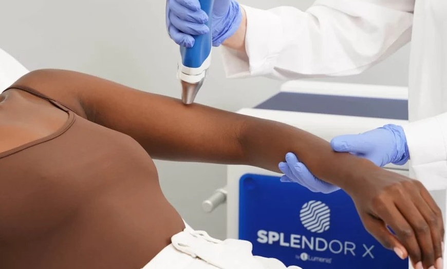 Image 1: Smooth Skin with Six Laser Hair Removal Sessions on Different Areas