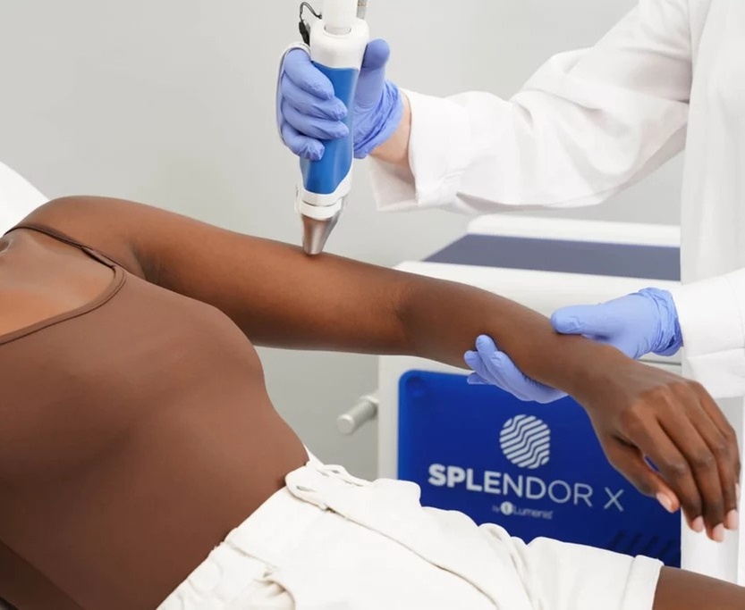 Smooth Skin with Six Laser Hair Removal Sessions on Different Areas