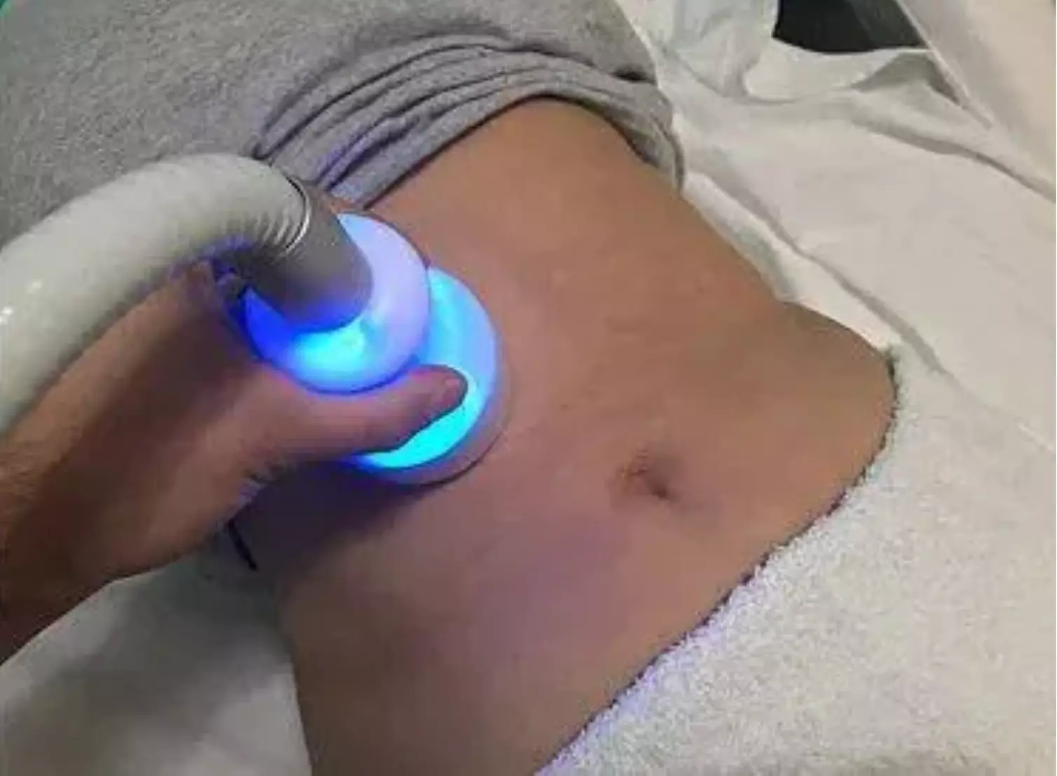 Up to 37% Off on Cryotherapy at Beautisculpt Studio - Primary Image
