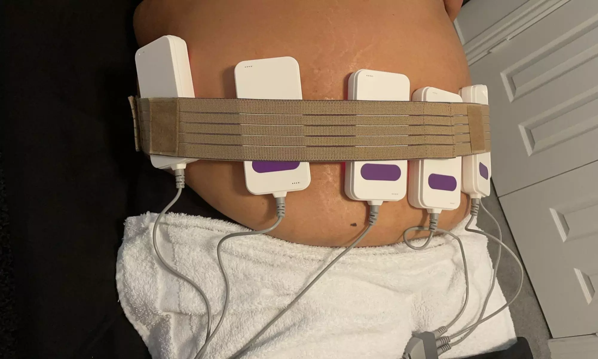 Up to 40% Off on Ultrasonic Fat Reduction at Bellebeautyclinic - Second Medium