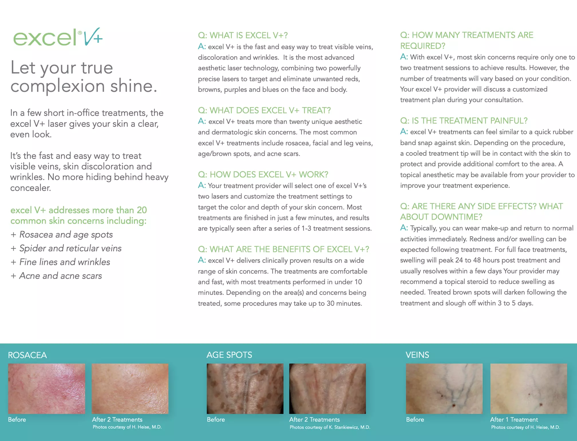 Up to 64% Off on Spider Vein Removal at Texas Heart and Vein Multispecialty Group