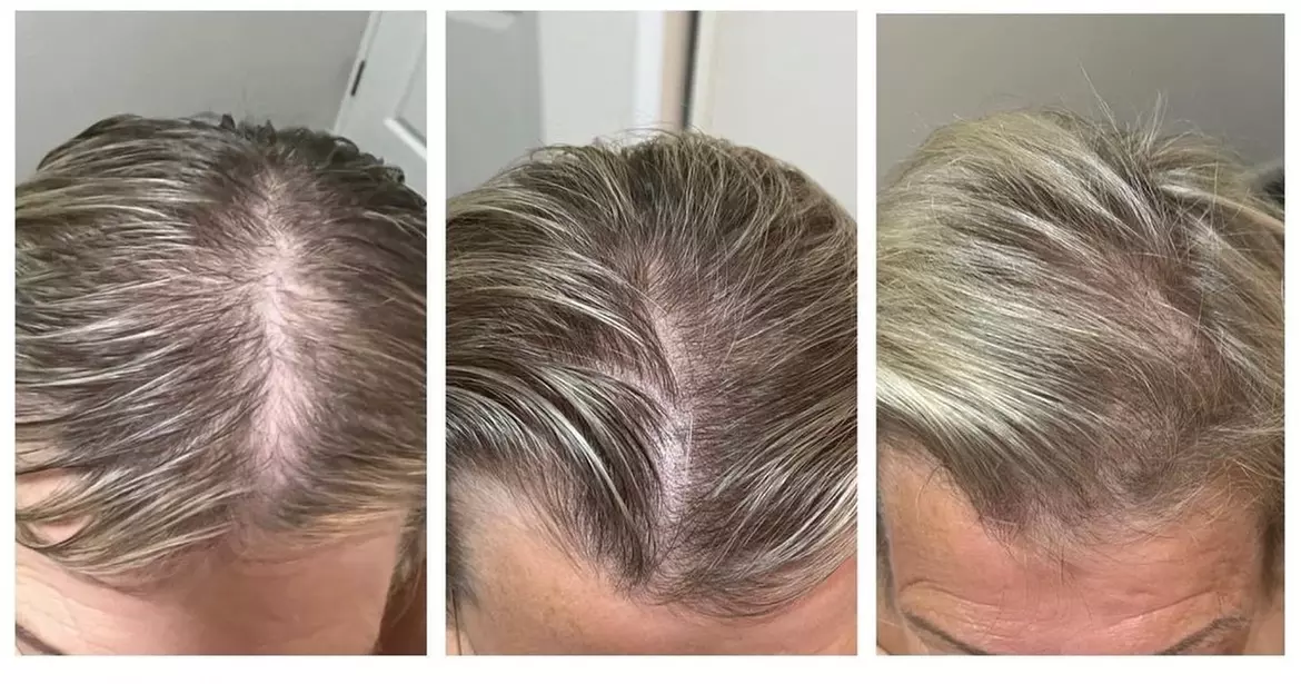 Up to 67% Off on Salon - Hair Straightening Treatment at UK Aesthetics Lounge