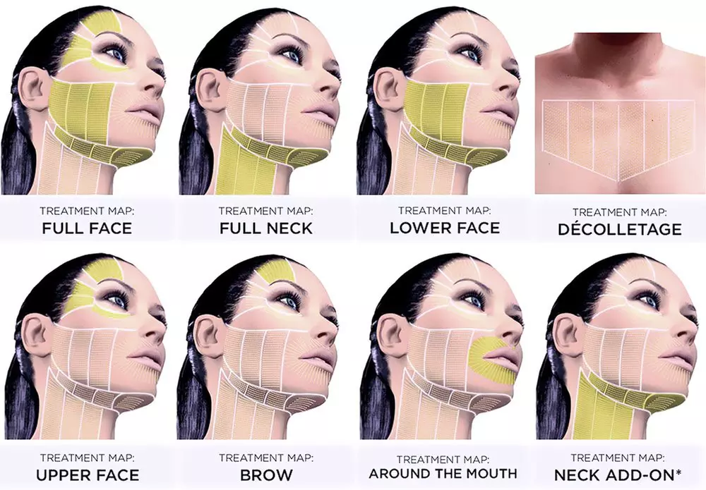 Up to 82% Off on 7D HIFU Lifting & Rejuvenation – Face, Body & Feminine Treatments w/ Bonus Bio-Collagen Mask - Second Medium