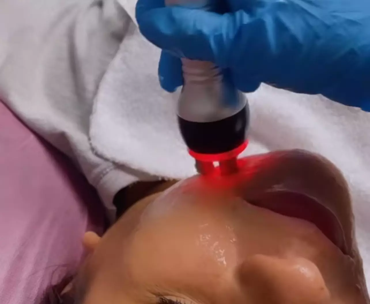 Up to 56% Off on Radio Frequency Skin Tightening at Az browz & body by brina - Primary Image