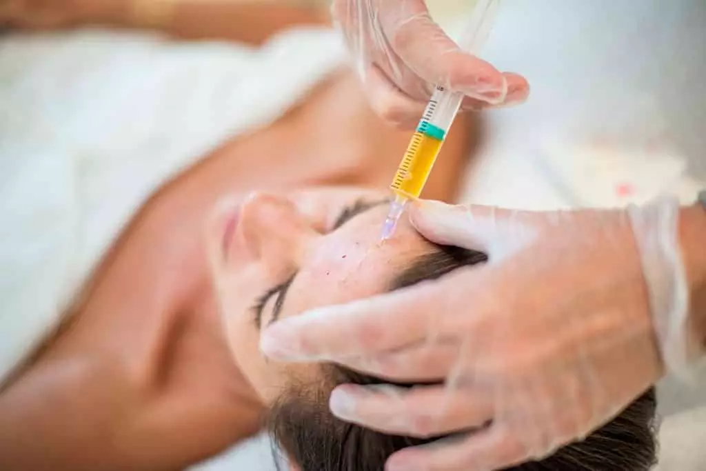 Revitalize Skin with Microneedling Acne Treatments