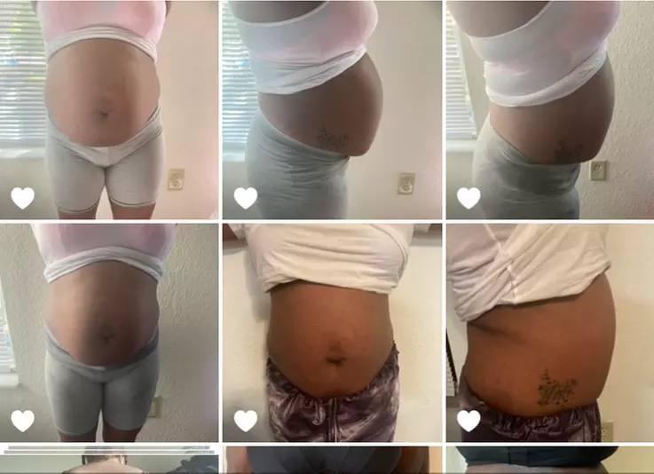 Discover Noire Body Sculpting with options like Laser Lipo & Ultrasonic Sessions up to 50% off - Primary Image