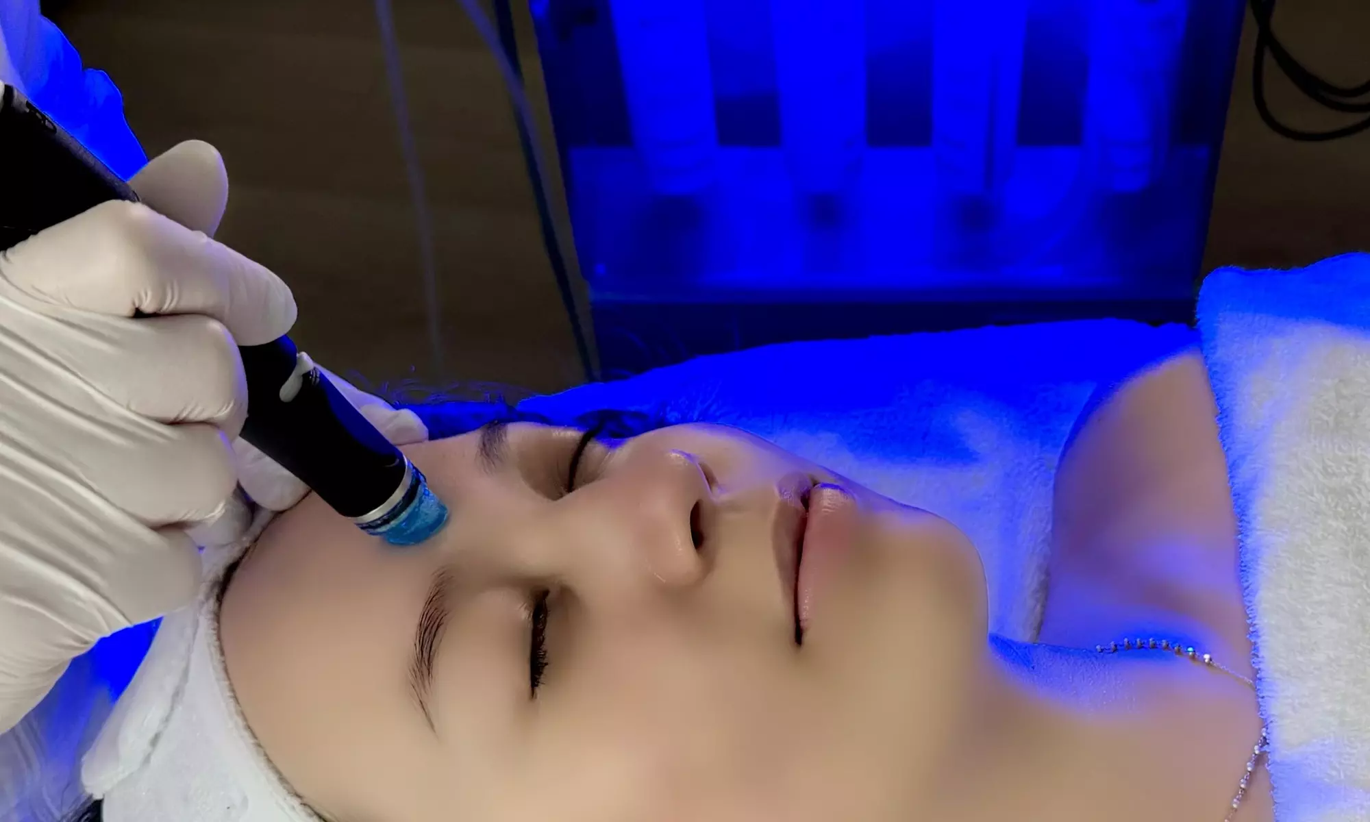 Up to 35% Off on HydraFacial at L'Lily Aesthetics - Primary Image