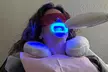 In-Office Teeth Whitening (45 or 60 Minutes) with Optional High-Power Booster - Second Medium