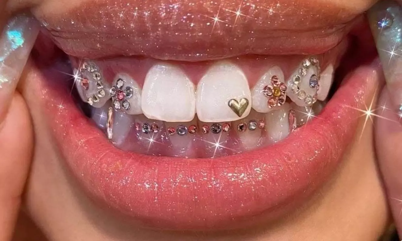 Up to 50% Off on Teeth Whitening at Truly Naked Beauty - Primary Image