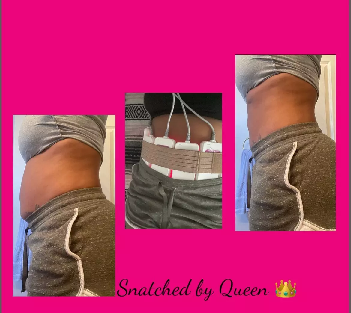 Up to 60% Off on Non-Surgical Butt Lift at Snatched By Queen - Second Medium