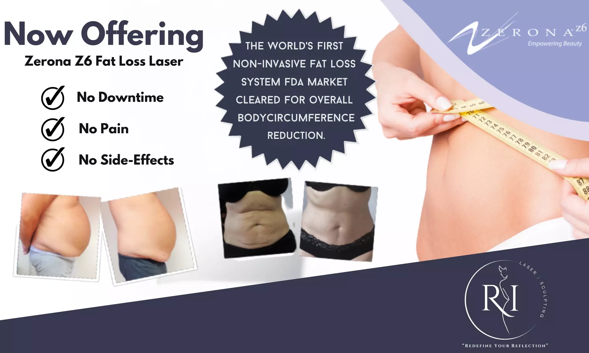 Transform Your Body with 6 Zerona Z6 Treatments for Ultimate Weight Management (Up to 35% Off) - Primary Image