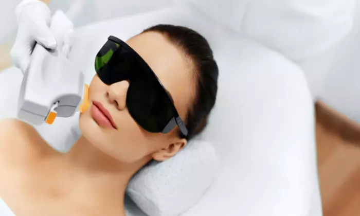Up to 60% Off on IPL Photo Facial at Image Lift - Primary Image