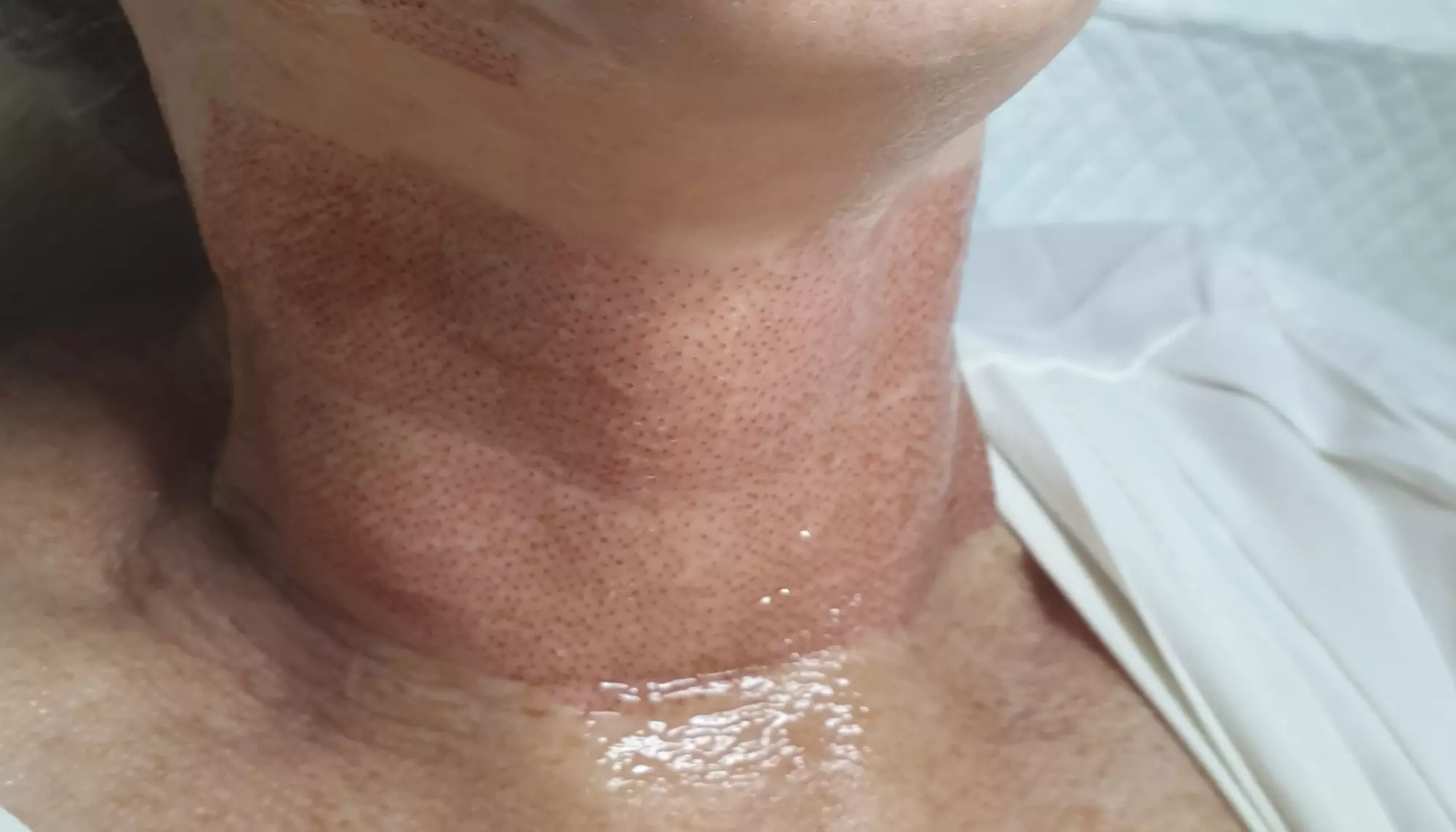 Up to 46% Off on Facial - Thermal Rejuvenation at Ana's Holistic Health and Beauty