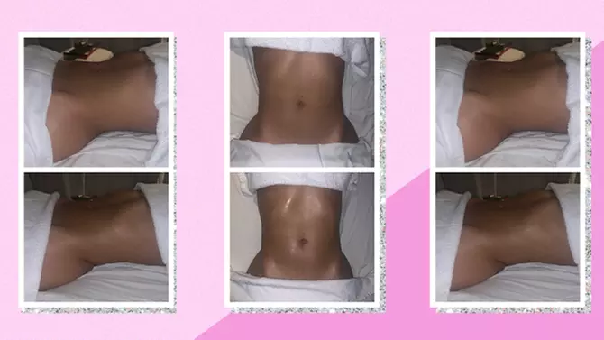 Up to 52% Off on Lipo - Non-Invasive Laser-iLipo at Shapes Lymphatic