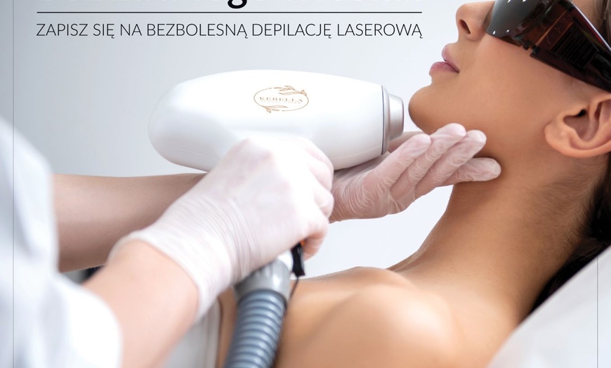 Image 2: Depilacja laserowa w firmie Fabryka Piękna 