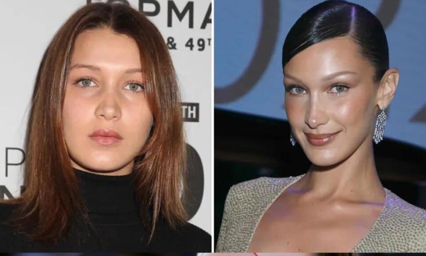 Image 2: Bella Hadid Style Eyebrow Lift With PDO Threads at No Pain All Gain Spa (Up to 30% Off)